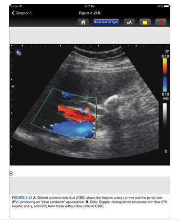 Download Ultrasound Probe for iPad